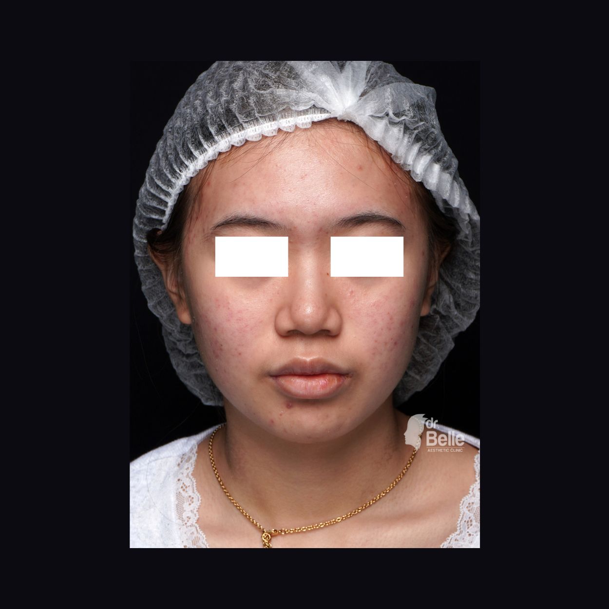 After treatment pasien 1