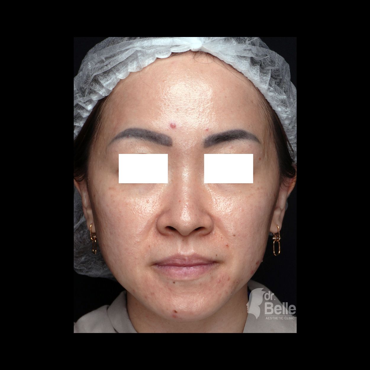 After treatment pasien 2